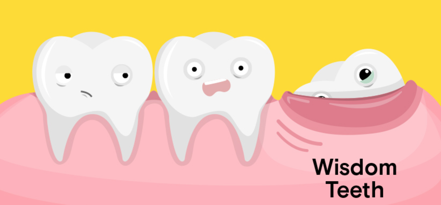 Wisdom Teeth Big Black Cock